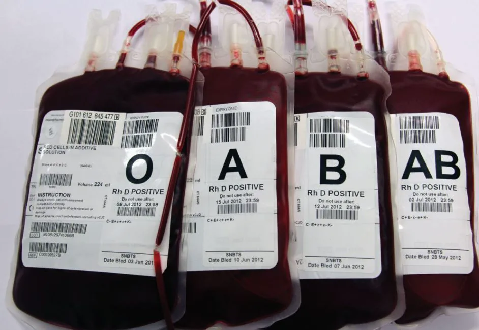 Blood bag labels with blood group identification manufactured by Adcal Labels